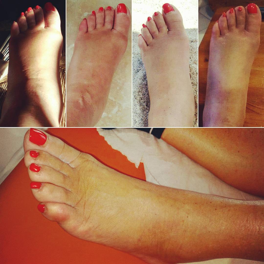 FisioK Studio di Fisioterapia - Dott. Lefosse Pietro Luigi · Foto 10